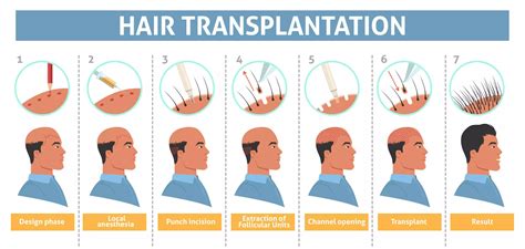 Hair Donation Procedure .